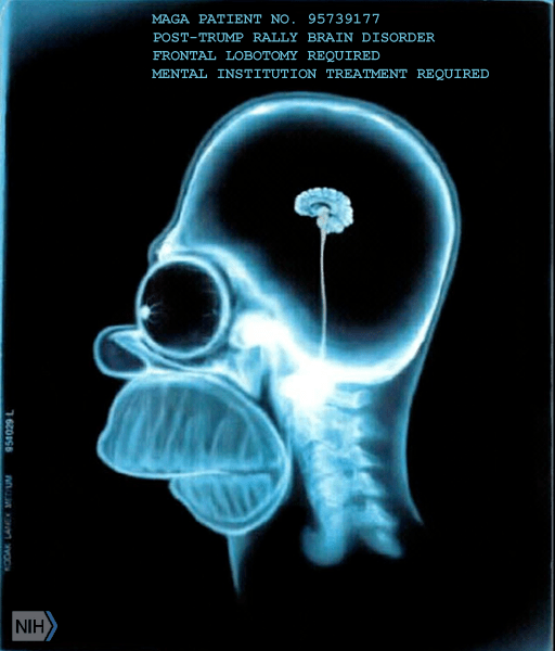 maga_xray_nimh